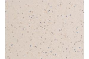 ABIN6267244 at 1/100 staining mouse brain tissue sections by IHC-P. (MITF anticorps  (pSer73, pSer180))