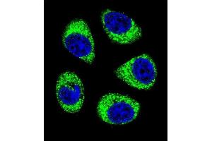 Confocal immunofluorescent analysis of SLC25A6 Antibody (Center) (ABIN656122 and ABIN2845461) with A549 cell followed by Alexa Fluor 488-conjugated goat anti-rabbit lgG (green). (SLC25A6 anticorps  (AA 128-155))