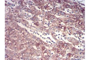 Immunohistochemistry (IHC) image for anti-Transthyretin (TTR) (AA 1-147) antibody (ABIN5875576) (TTR anticorps  (AA 1-147))