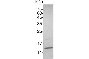 SDS-PAGE (SDS) image for Interferon gamma (IFNG) (Active) protein (His tag) (ABIN7884416)