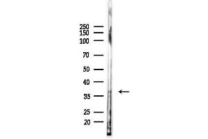 Western blot analysis of lysates from Mouse liver, using ERCC1 Antibody at 1/1000 dilution.