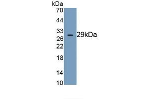 Detection of Recombinant DNAH11, Human using Monoclonal Antibody to Dynein, Axonemal, Heavy Chain 11 (DNAH11) (DNAH11 anticorps  (AA 3896-4122))