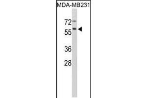 Western blot analysis of in MDA-MB231 cell line lysates (35ug/lane)