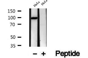Western blot analysis of extracts of HeLa cells, using VPS16 antibody. (VPS16 anticorps  (Internal Region))