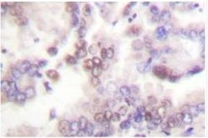 Image no. 1 for anti-Cyclin-Dependent Kinase Inhibitor 2B (p15, Inhibits CDK4) (CDKN2B) antibody (ABIN271760) (CDKN2B anticorps)