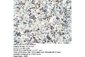 Rabbit Anti-HSD17B6 Antibody  Paraffin Embedded Tissue: Human Liver Cellular Data: Hemopoietic Antibody Concentration: 4. (HSD17B6 anticorps  (N-Term))