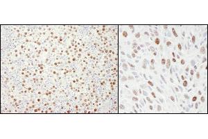 Immunohistochemistry (IHC) image for anti-Minichromosome Maintenance Deficient 4 (MCM4) (AA 750-800) antibody (ABIN7454513) (MCM4 anticorps  (AA 750-800))