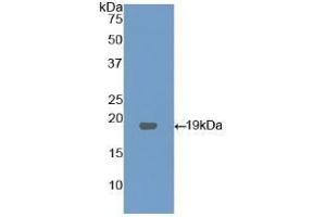 Detection of Recombinant LPCAT3, Human using Polyclonal Antibody to Lysophosphatidylcholine Acyltransferase 3 (LPCAT3)