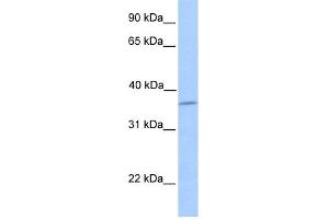 WB Suggested Anti-LAYN Antibody Titration: 0. (Layilin anticorps  (N-Term))