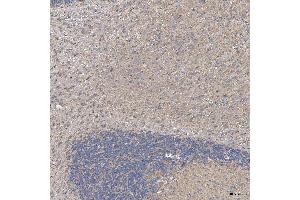 IHC analysis of SLC20A1 using anti-SLC20A1 antibody (ABIN7602463).