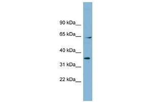 RanGAP1 antibody used at 1 ug/ml to detect target protein. (RANGAP1 anticorps  (N-Term))