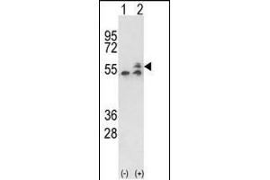 Western blot analysis of ATP5B (arrow) using rabbit polyclonal ATP5B Antibody (Center) (ABIN650786 and ABIN2839558).