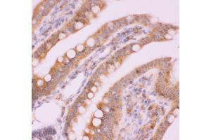 Anti-NFkB p100 Picoband antibody,  IHC(P): Rat Intestine Tissue