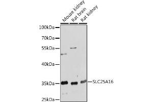 Western blot analysis of extracts of various cell lines, using SLC25 Rabbit pAb (ABIN7270432) at 1:1000 dilution. (SLC25A16 anticorps  (AA 200-300))