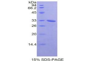 SDS-PAGE analysis of Mouse NEK2 Protein. (NEK2 Protéine)