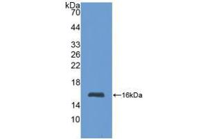 Western blot analysis of recombinant Human MT1. (MT1 anticorps  (AA 1-61))