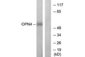 Western blot analysis of extracts from COLO cells, using OPN4 Antibody. (OPN4 anticorps  (AA 429-478))