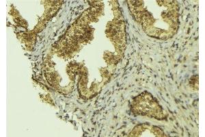 ABIN6276517 at 1/100 staining Mouse colon tissue by IHC-P. (BCL2L13 anticorps  (Internal Region))