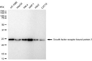 Western blotting analysis using Growth factor receptor bound protein 2 antibody (ABIN7798807).
