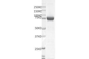 Recombinant SMYD4 protein gel.