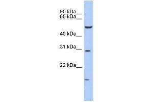 WB Suggested Anti-HOXC5 Antibody Titration: 0. (Homeobox C5 anticorps  (Middle Region))