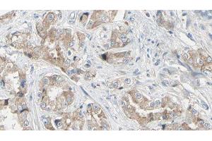 ABIN6279343 at 1/100 staining Human prostate tissue by IHC-P.