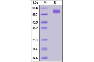 Biotinylated SARS-CoV-2 S2 protein, His,Avitag™ on  under reducing (R) condition.