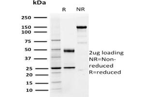SDS-PAGE Analysis of Purified PD-L1 Mouse Monoclonal Antibody ABIN6383847.