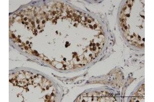 Image no. 1 for anti-Cytoskeleton Associated Protein 2 (CKAP2) (AA 1-162) antibody (ABIN599549) (CKAP2 anticorps  (AA 1-162))