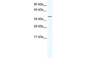 WB Suggested Anti-IRX6 Antibody Titration:  1. (IRX6 anticorps  (C-Term))