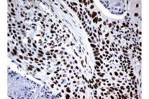 Image no. 6 for anti-Nibrin (NBN) (AA 461-754) antibody (ABIN1491540)