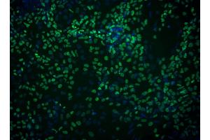 Immunofluorescent staining of FoxA2 in definitive endoderm derived from human embryonic stem (ES) cells.
