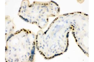 anti-Damage Specific DNA Binding Protein 1 (DDB1) (AA 1011-1140) antibody