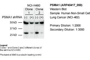 Sample Type: Human non-small cell lung cancer (NCI-460)Primary Dilution: 1:2000Secondary Dilution: 1:300050kDa band is a tubulin loading control band (PSMA1 anticorps  (C-Term))