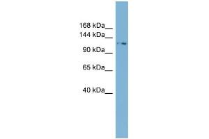 WB Suggested Anti-TTC17 Antibody Titration: 0. (TTC17 anticorps  (N-Term))