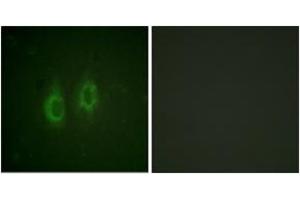 Immunofluorescence analysis of HeLa cells, using Connexin 43 (Ab-261) Antibody. (Connexin 43/GJA1 anticorps  (AA 226-275))