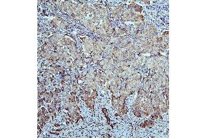 IHC analysis of ALDH1A1 using anti-ALDH1A1 antibody (ABIN7602127). (ALDH1A1 anticorps  (AA 6-342))