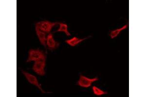 ABIN6266557 staining NIH-3T3 by IF/ICC. (HCG beta anticorps)