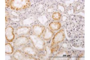 Image no. 1 for anti-ACC Synthase-Like Protein 1 (ACCS) (AA 1-101) antibody (ABIN466256) (PHACS anticorps  (AA 1-101))