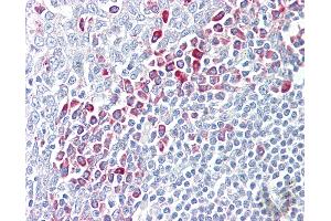 Anti-PARP6 antibody IHC of human tonsil. (PARP6 anticorps  (AA 431-480))