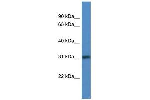WB Suggested Anti-TBRG1 Antibody Titration: 0. (TBRG1 anticorps  (N-Term))
