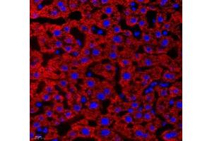 Immunofluorescence of paraffin embedded human liver using Aldh4a1 (ABIN7073000) at dilution of 1: 400 (400x lens)