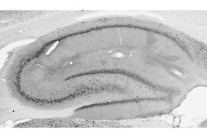 anti-Actin-Like 6B (ACTL6B) (AA 39-114) antibody