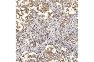 IHC analysis of SNF2H/SMARCA5 using anti-SNF2H/SMARCA5 antibody (ABIN7602001).