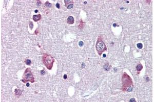 Brain, cortex, Human: Formalin-Fixed, Paraffin-Embedded (FFPE) (BDNF anticorps  (AA 183-194))