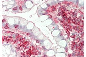 Rabbit Anti-ST3GAL4 antibody  Formalin Fixed Paraffin Embedded Tissue: Human Small Intestine Primary antibody Concentration: 1:200 Secondary Antibody: Donkey anti-Rabbit-Cy3 Secondary Antibody Concentration: 1:200 Magnification: 20x Exposure Time: 0.