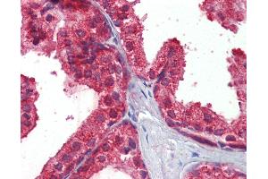 Anti-CLIP1 / CLIP170 antibody IHC of human prostate. (CLIP1 anticorps  (AA 1404-1417))