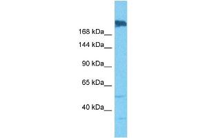 Host:  Rabbit  Target Name:  SNRNP200  Sample Tissue:  Human A549 Whole Cell  Antibody Dilution:  1ug/ml (SNRNP200 anticorps  (N-Term))