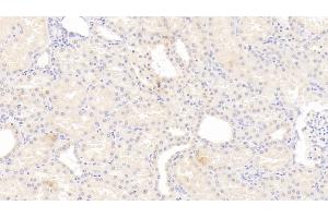 Detection of IL12B in Human Kidney Tissue using Monoclonal Antibody to Interleukin 12B (IL12B)