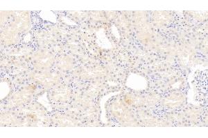 Detection of IL12B in Human Kidney Tissue using Monoclonal Antibody to Interleukin 12B (IL12B) (IL12B anticorps  (AA 30-320))